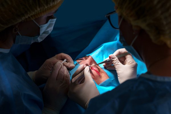 Rajeunissez votre regard : découvrez la blépharoplastie à marseille